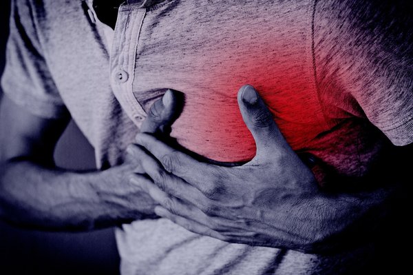 Infarctus de myocarde : les essentiels à retenir pour agir